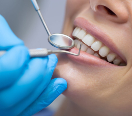 Best Dentist in Hyderabad – How to Choose