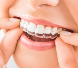 Invisalign Clear Aligners Cost in Hyderabad